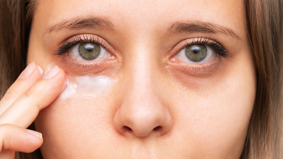 Tips para eliminar las ojeras