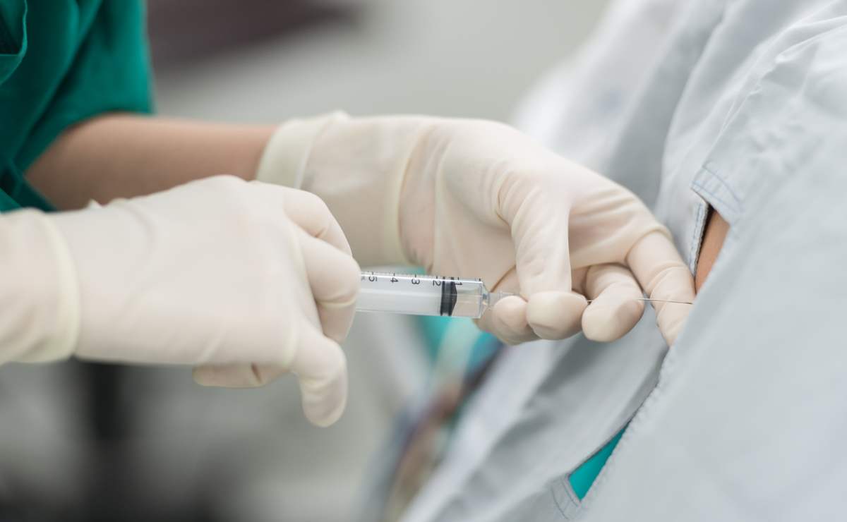 Qué es la anestesia epidural y por qué es tan temida