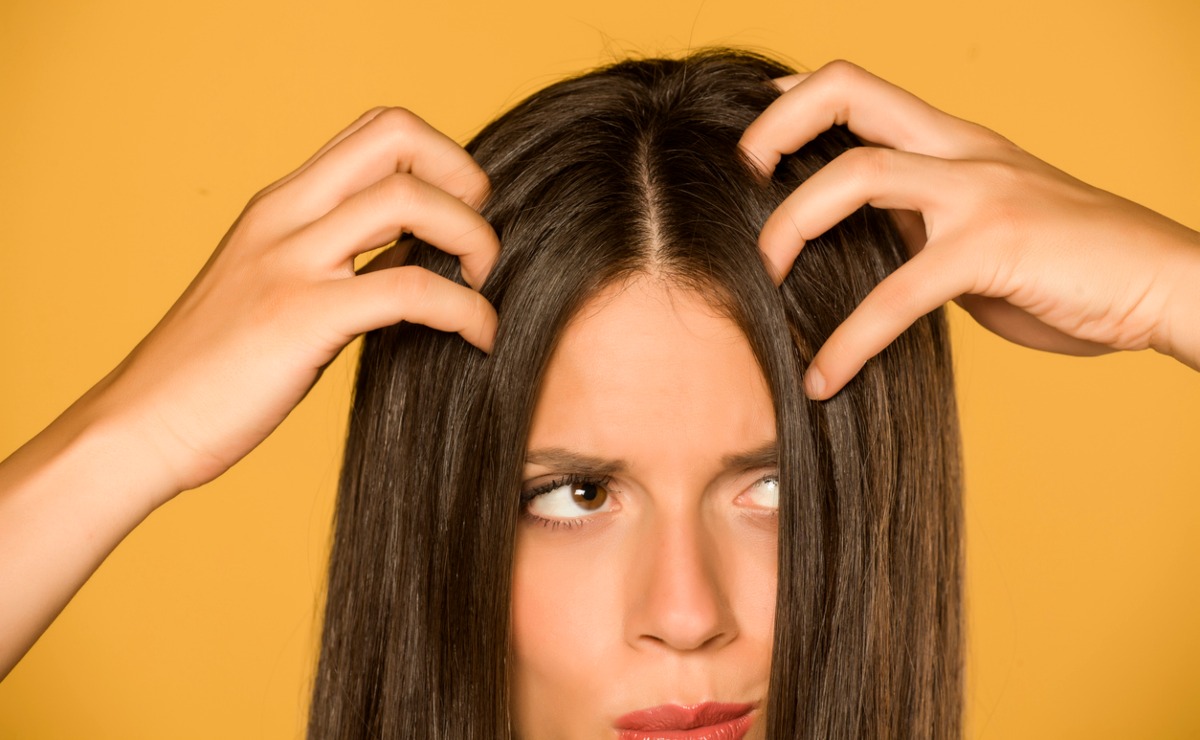 Qué ocasiona la caspa en el pelo y cómo prevenir su aparición