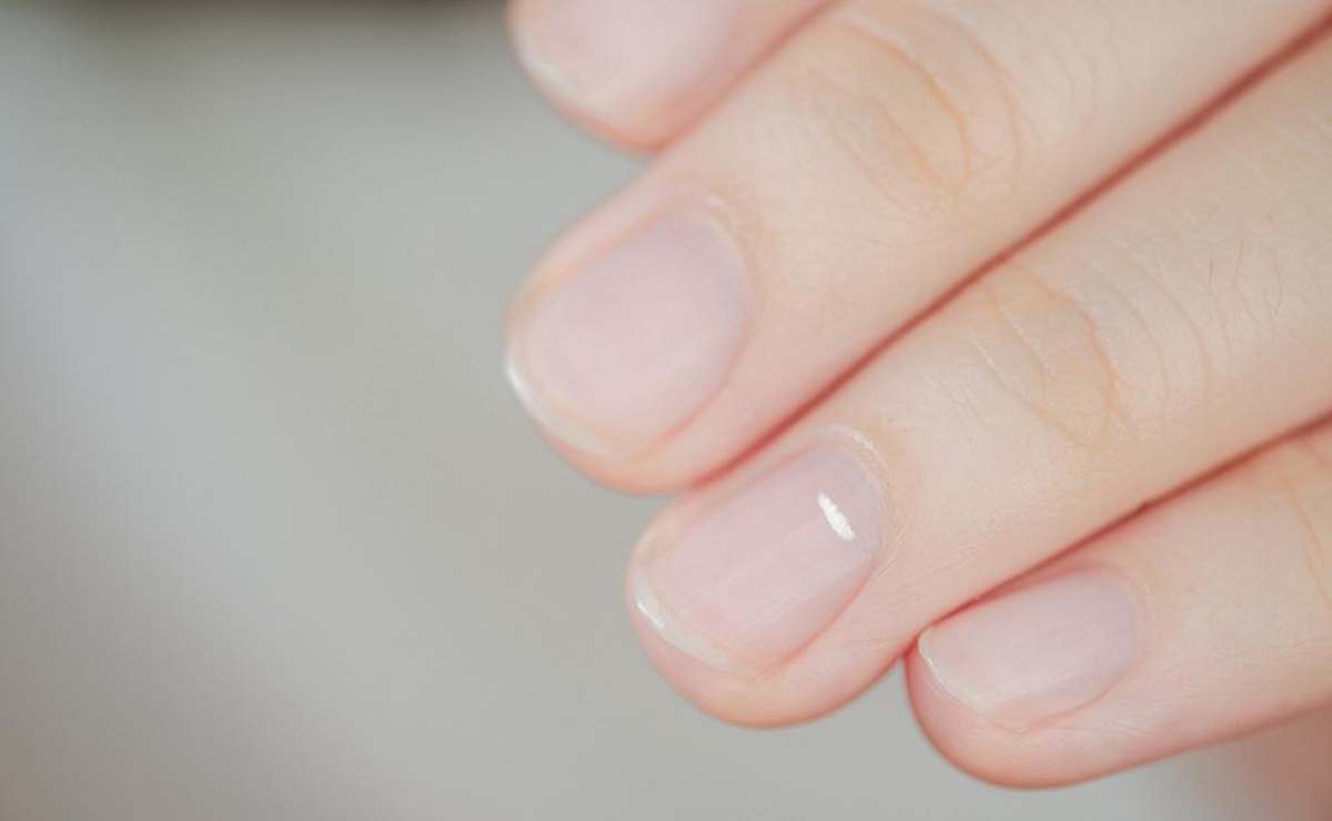 Qué son y por qué aparecen las ‘manchas blancas’ en las uñas