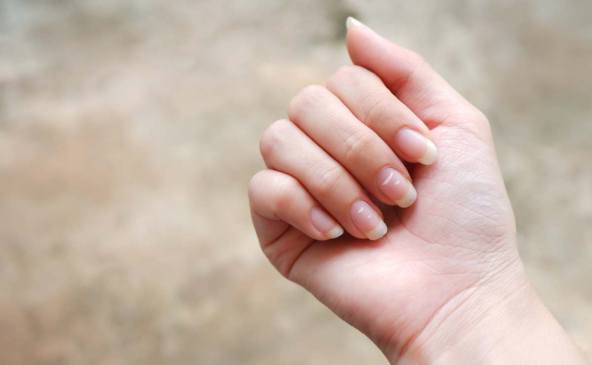 Por qué salen manchas blancas en las uñas